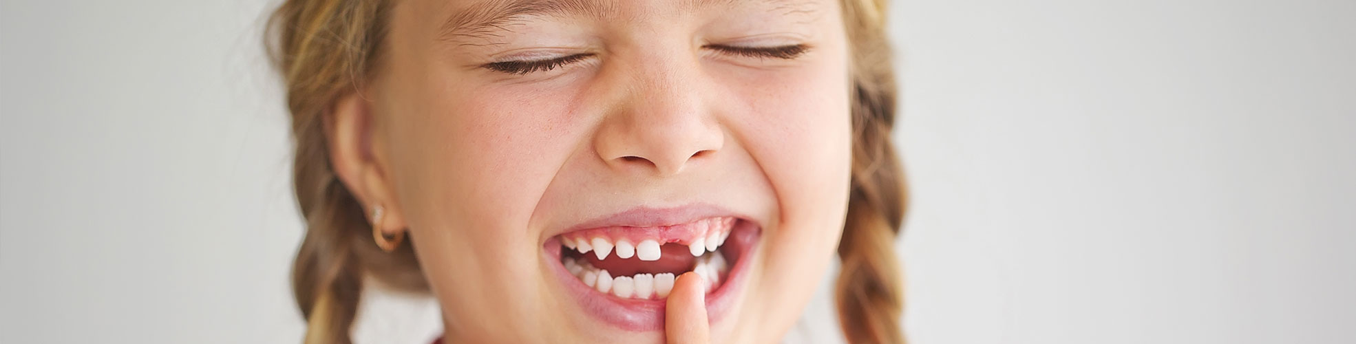 bimba manca un dente