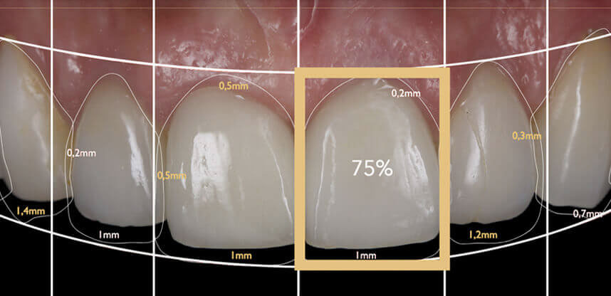digital smile design